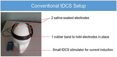 Anatomical Parameters of tDCS to Modulate the Motor System after Stroke: A Review